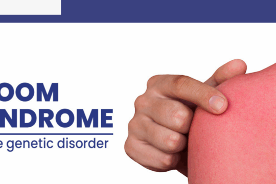 What Is Bloom Syndrome and How It Affects Health